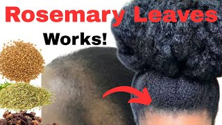 Rosemary and Cloves For Extreme Hair Growth | Overnight Results