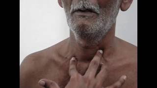 Famous Tracheal palpation - Insinuation method (video only) Net Worth
