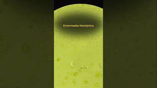 Entamoeba histolytica. // is a parasitic protozoan that causes amoebiasis.