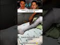 Te van a operar en el IMSS y decides marcar la pierna correcta para prevenir