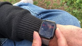 Apple Watch, la nostra prova: un elettrocardiogramma all'aria aperta -  YouTube