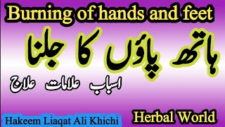 Burning Of Hands And Feet|| ہاتھ پاؤں کے جلنے کا دیسی علاج||Herbal World||Hakeem Liaqat Ali Khichi