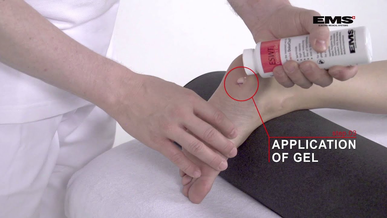 Shockwave Therapie Plantar Fasciitis YouTube