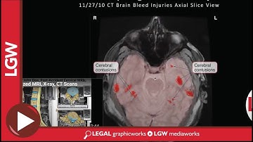 Animated Colorized MRI and CT Scans