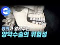 양악수술은 어떻게 할까? 입체 영상으로 알아보는 수술 사례