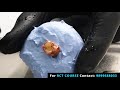 Endo Access Preparation - Maxillary First Molar- Live Demo General Dentistry Course- Root Canal