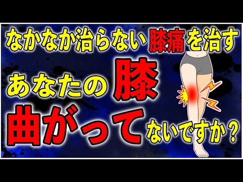 変形性膝関節症・股関節痛・むくみ　ダブルモーションテクニック〈下肢編〉 変形性膝関節症・股関節痛・むくみ ダブルモーションテクニック