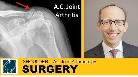 Shoulder - AC joint Arthritis