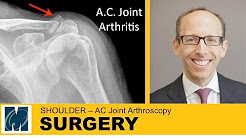 Shoulder - AC joint Arthritis