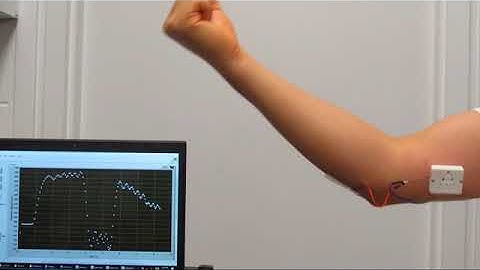 Life demo of the wearable motion sensor