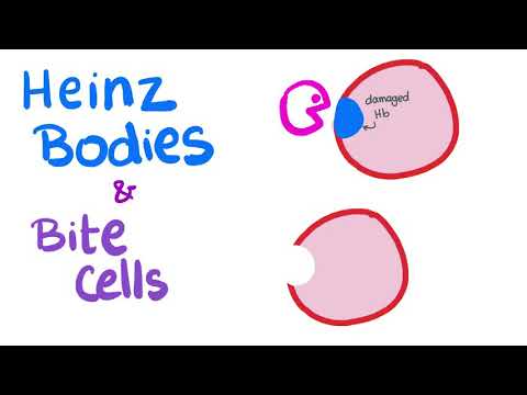 Heinz Bodies and Bite Cells