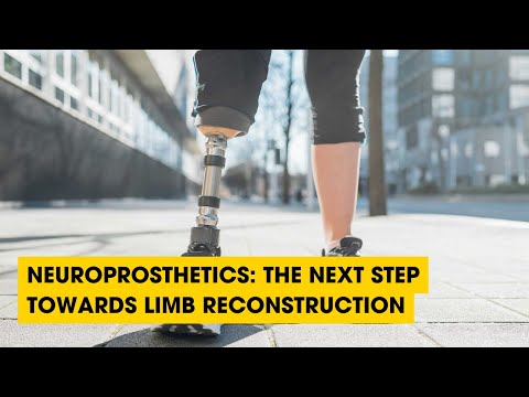 Neuroprosthetics: The Next Step Towards Limb Reconstruction