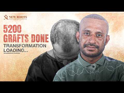 One Surgery. One Dream. One New Beginning ❤️ | Hair Transplant in Bangladesh | New Roots | Bangla