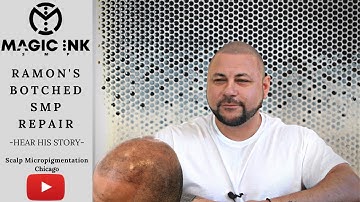 Bad SMP Repair | Ramon