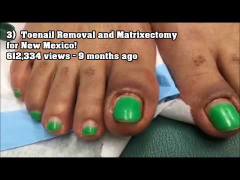 Worst Nails, Cellulitis, Pus, Popping & Abscess! Worst Nails, Cellulitis, Pus, Popping & Abscess!