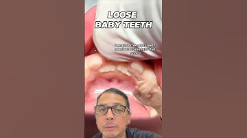 Why it’s NECESSARY to Remove Loose Baby Teeth | View Mobile Dental #shorts