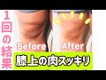 【脚痩せ】驚愕のBefore＆After!! 膝上の肉を落とす方法