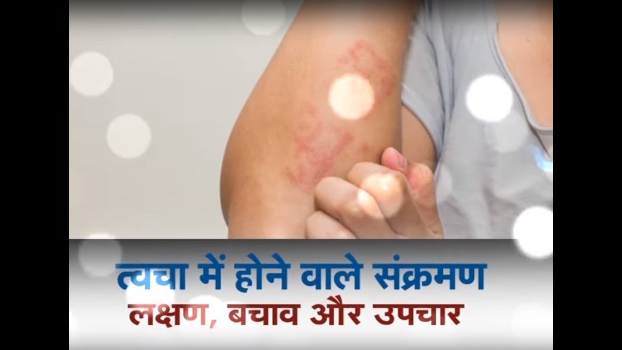 Swasth Kisan - त्वचा में होने वाले संक्रमण Promo farmers insurance