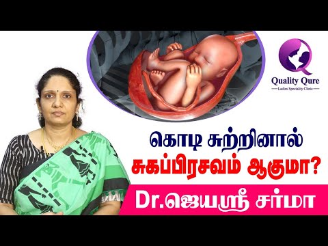 கொடி சுற்றினால் சுகப்பிரசவம் (Normal Delivery) ஆகுமா??? I Dr.Jayasree Sharma I Quality qure