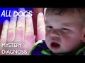 The Boy Who Kept Swelling: Erthropoietic Protoporphyria (EPP) | Medical Documentary | Reel Truth