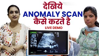 Anomaly scan in pregnancy -Dr Asha Gavade screenshot 4