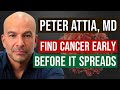 Peter Attia, MD: How to Detect Cancer Early - Before it Spreads