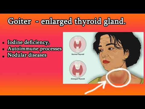 Video: Endemic Goiter - Treatment, Symptoms, Prevention