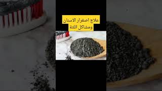 علاج اصفرار الاسنان ومشاكل اللثة