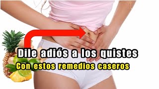 Remedios caseros para eliminar los quistes de ovarios para siempre.