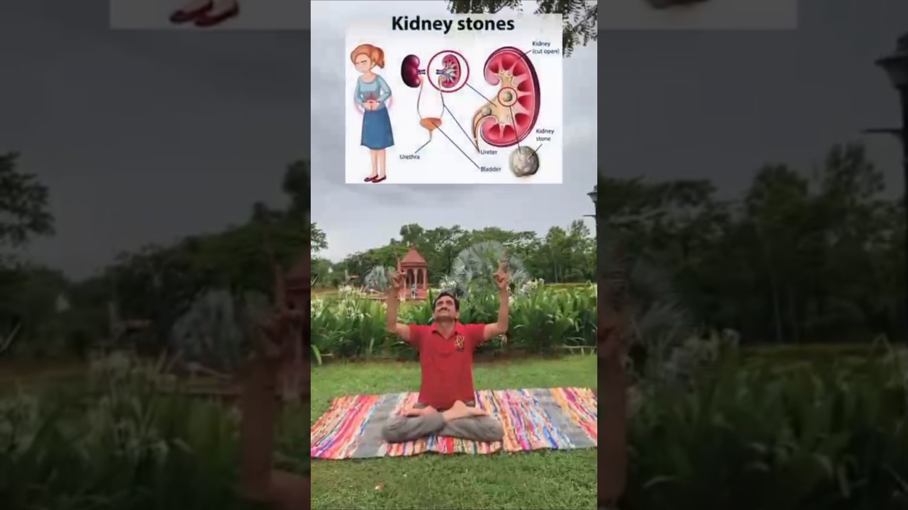 Yoga for kidney stones 