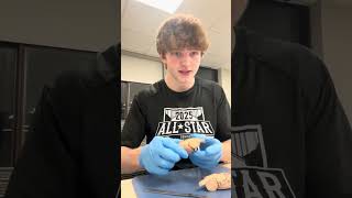 Brain dissection lab bio 220