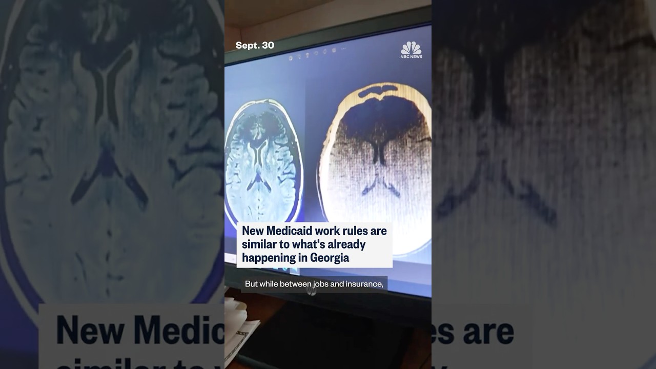 New Medicaid work rules are similar to what’s already happening in Georgia