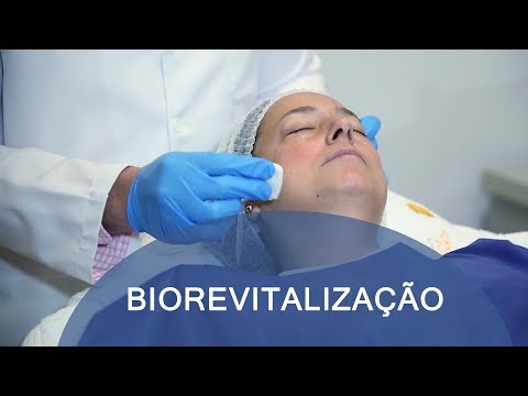 Vídeo: Biorevitalização Com ácido Hialurônico