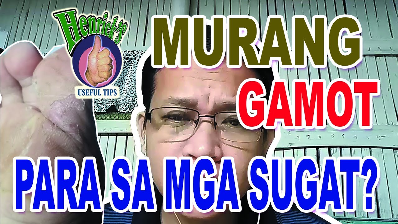 Murang Gamot para sa Sugat? Ano ito / Home Remedy for Wound - YouTube