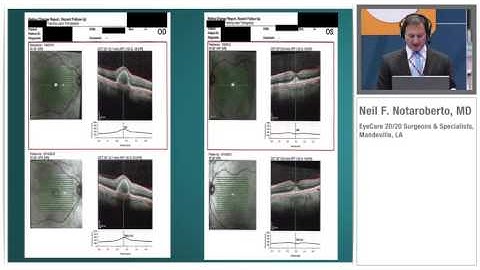 Retina Functional Analysis: The Missing Link in the Evaluation and Management of Retinal Disease