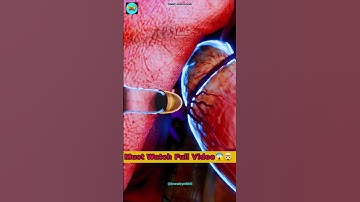 How A Bullet Goes Through A Body in 3D Animation #shortvideo