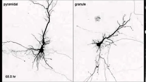 PLoS ONE : Differentiation of Apical and Basal Dendrites in Pyramidal Cells and Granule Cells...
