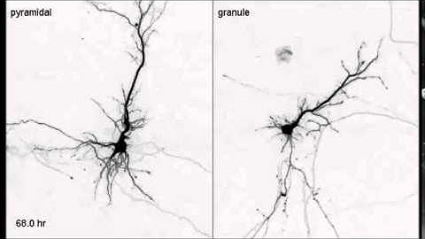 PLoS ONE : Differentiation of Apical and Basal Dendrites in Pyramidal Cells and Granule Cells...