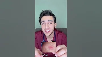 كيف تعرف أنك مصاب بمرض الكبد 