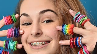 ألوان التقويم أنواعها واستخدامها. Braces Colours - types & its use