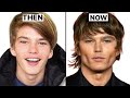 4 most common plastic surgeries male models get from a model