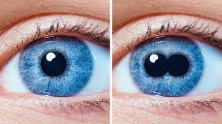 Dos pupilas en un ojo y otras extrañas características del cuerpo