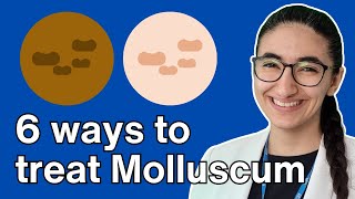 How to treat molluscum contagiosum with Pharmacist Virginia