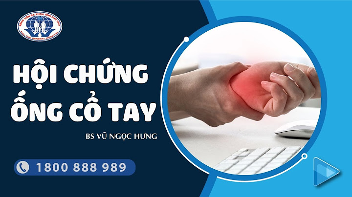 Các bài tập cho hội chứng ống cổ tay năm 2024