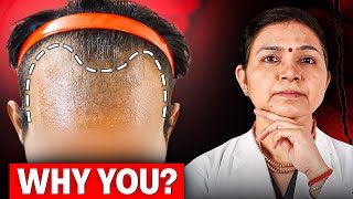 Receding Hairline And Hair Loss Most Men Ignore This And How You Can Reverse It Naturally