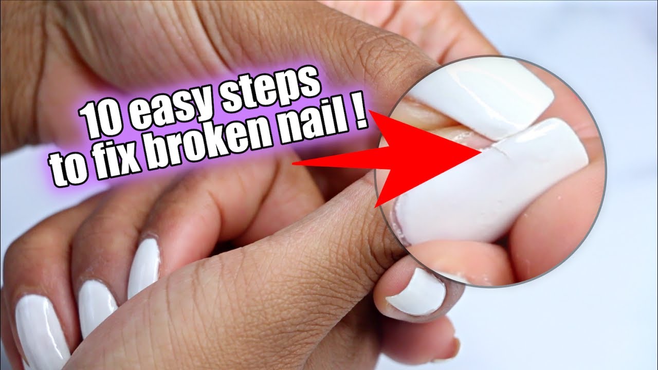 Amazon.com : Kiss New York Nail Repair Kit for Damage Nails, Broken Cracked  and Weak Nails, Biotin Infused Nail Glue, Nail File, and 2 Nail Wraps, Made  in Korea : Beauty &