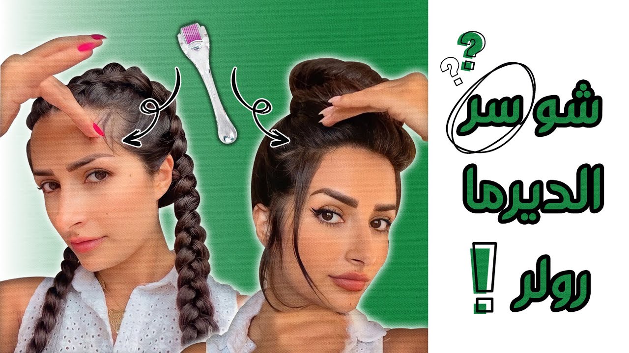 الديرما رولر وفعاليتها في إعادة إنبات الشعر،  تكثيفه ومعالجة مشكلة الفراغات معي أنا أخصائية الشعر.