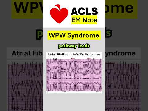 Wolff Parkinson White Or WPW Syndrome Acls