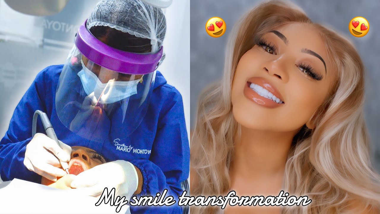 I WENT TO COLUMBIA TO GET MY TEETH DONE BY DR MARIO MONTOYA | CREE BANKZ