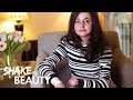 I’m Proud Of My Butterfly Skin | SHAKE MY BEAUTY